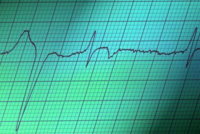 Кардиограмма сердца - РИА Новости, 1920, 10.10.2025
