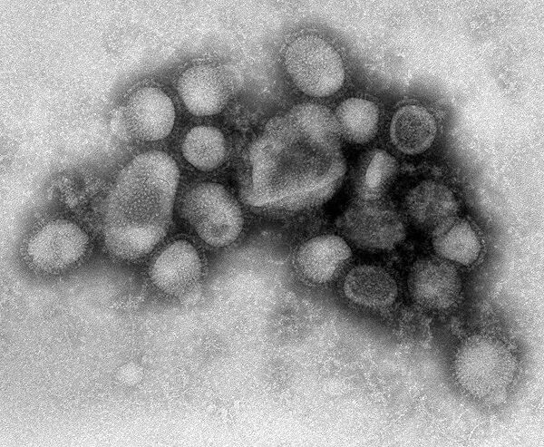 Вирус Свинного гриппа под микроскопом