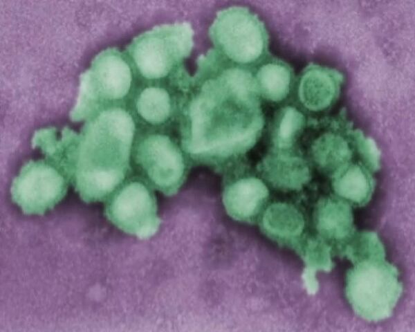 Пандемия свиного гриппа становится все более вероятной 