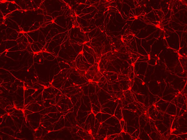 Нейроны, созданные из клеток кожи мышей с помощью воздействия генов
