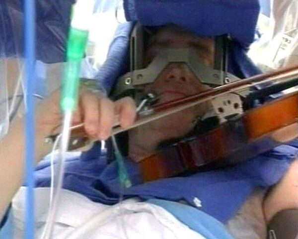 Музыкант играл на скрипке, пока врачи оперировали ему мозг 