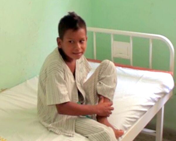 Десятилетний мальчик выжил после удара током в 13,8 тысяч вольт