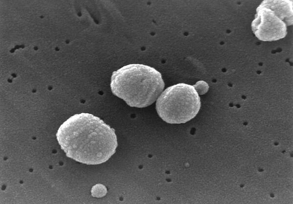 Бактерия Streptococcus pneumoniae. Архив