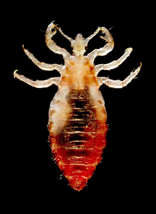 Платяная вошь, Pediculus humanus humanus L.