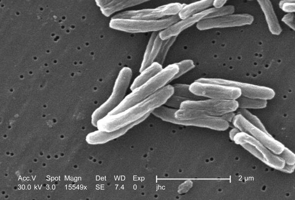 Возбудитель туберкулеза - бактерия Mycobacterium tuberculosis Возбудитель туберкулеза - бактерия Mycobacterium tuberculosis