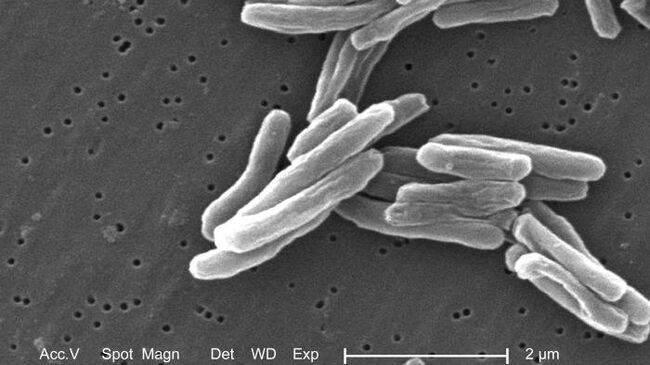 Возбудитель туберкулеза - бактерия Mycobacterium tuberculosis