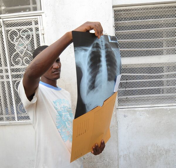 Первый случай заражения человека холерой зарегистрирован в Доминикане