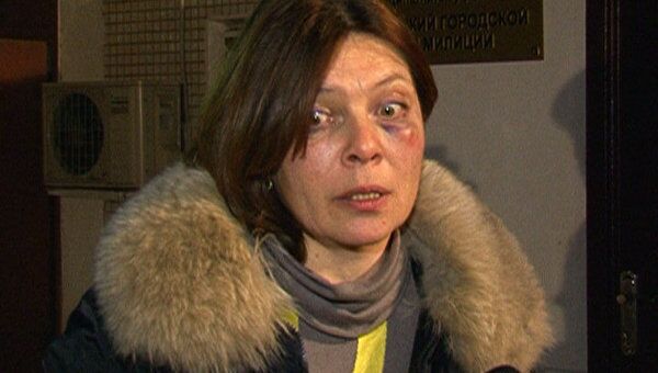 Наталья Сейбиль, заявившая об избиении ее человеком с удостоверением сотрудника МВД