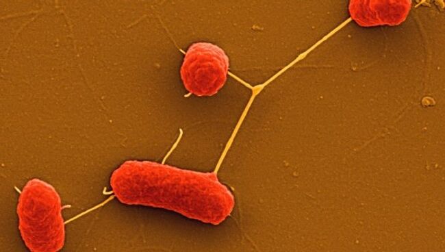 Энтерогеморрагическая бактерия Escherichia coli (EHEC) под микроскопом 