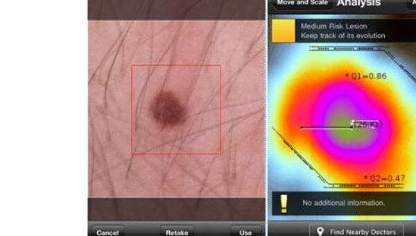 iPhone-приложение Skin Scan
