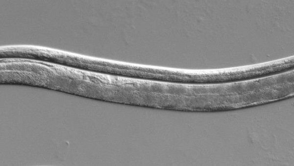 Спящая личинка (сверху) и взрослая особь (снизу) нематоды Caenorhabditis elegans