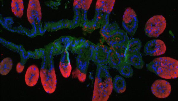 Клетки кишечника долгоносика, окруженные бактериями-симбионтами . Архивное фото