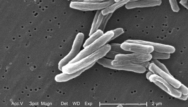 Возбудитель туберкулеза - бактерия Mycobacterium tuberculosis