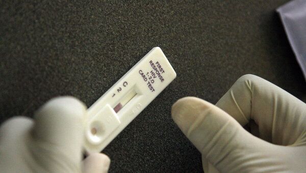 Экспресс-тестирование крови на наличие ВИЧ. Архив