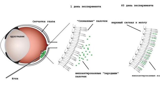 Процесс имплантации новых палочек в глаз грызуна, лишенного зрения из-за ошибки в геноме