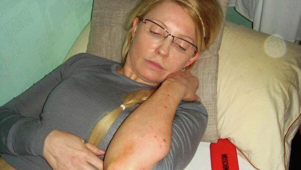 Юлия Тимошенко демонстрирует синяки на теле