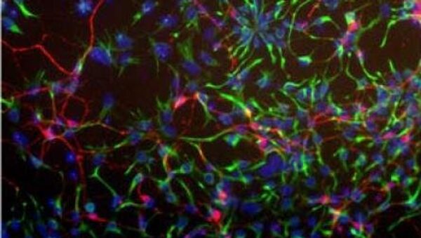 Нервные клетки, выращенные при помощи гормона активина из стволовых клеток мыши