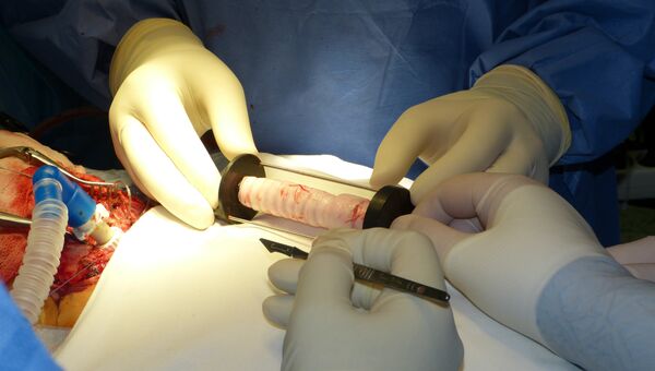 Искусственная трахея, приготовленная для трансплантации в Краснодарской краевой клинической больнице имени С.В.Очаповского