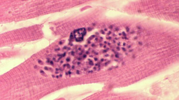 Паразит токсоплазма (Toxoplasma gondii) внутри клетки