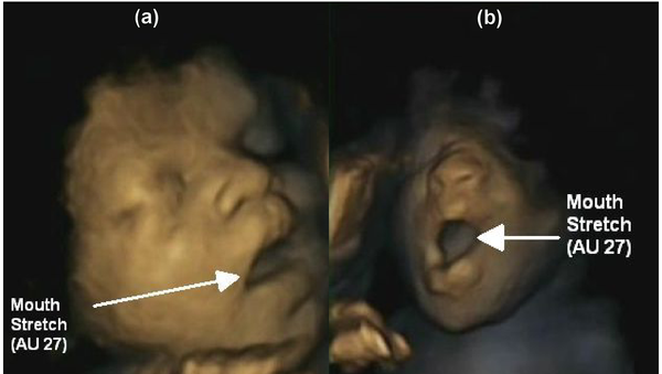 Зевающие младенцы в утробе матери