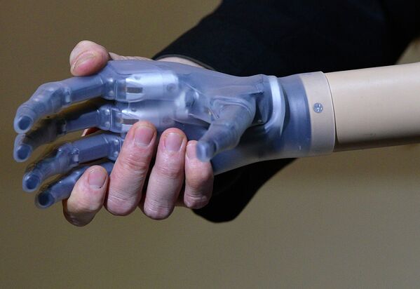 Рука бионического робота Rex