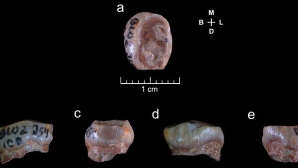 Фотографии зуба древнего человека и компьютерная реконструкция несохранившихся тканей