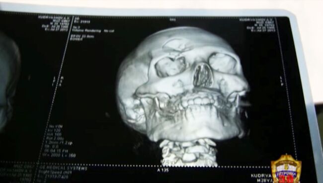 Полицейский получил черепно-мозговую травму при задержании подозреваемого в изнасиловании 15-летней девочки в Москве