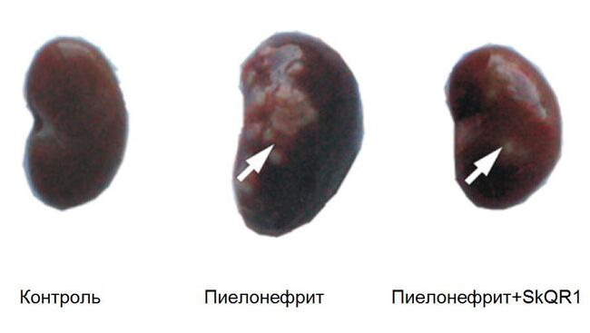 Воздействие антиоксиданта SkQR1 на почку, пораженную пиелонефритом