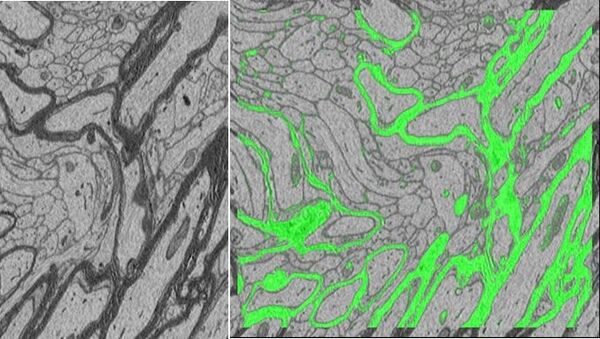 Нервные волокна мозга мыши, покрытые миелиновой оболочкой (на левой картинке она выглядит черной, на правой - зеленой)