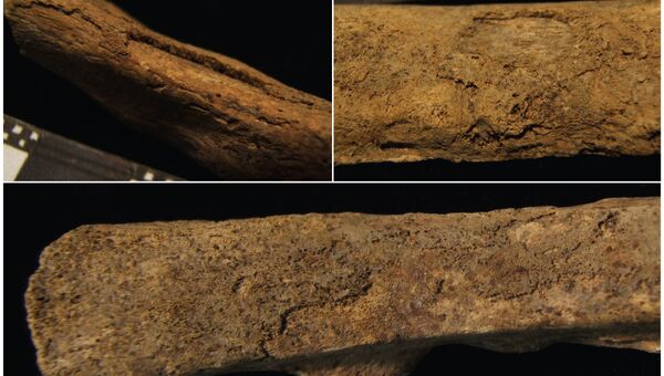 Кости со следами гипертрофической легочной остеопатии из неолитического захоронения на юге Венгрии, архивное фото