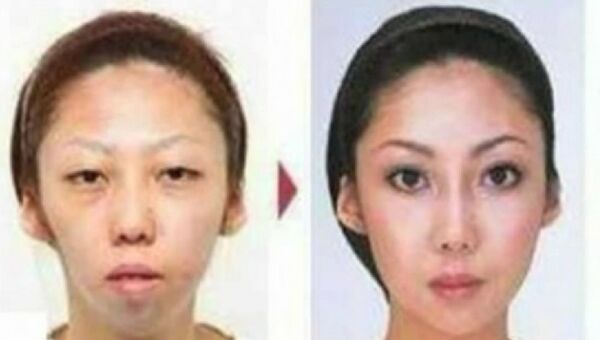 Жена китайца Цзянь Фенга до и после операции