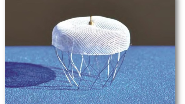 Зонтичный окклюдер ушка левого предсердия Зонтичный окклюдер ушка левого предсердия