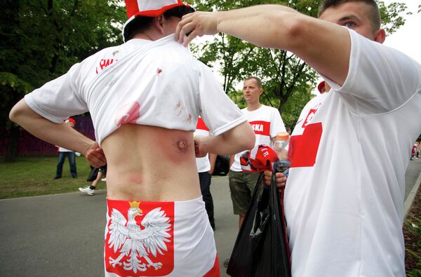 Польский фанат показывает след от резиновой пули