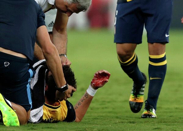 Нападающий Атлетико Марио Манджукич, сломавший нос в матче ЛЧ с Олимпиакосом
