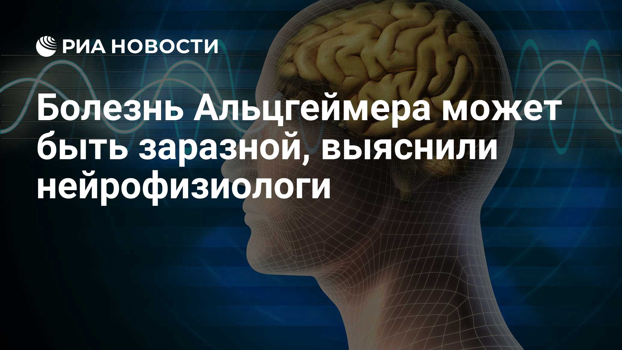 Болезнь Альцгеймера может быть заразной, выяснили нейрофизиологи - РИА  Новости, 09.09.2015