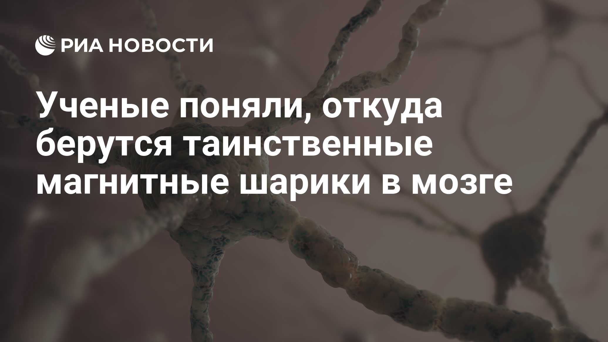 Ученые поняли, откуда берутся таинственные магнитные шарики в мозге - РИА  Новости, 06.09.2016