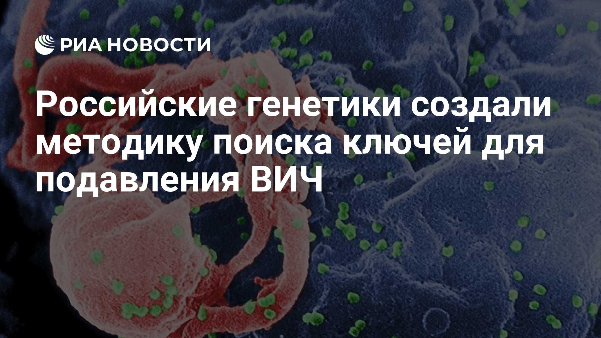 Российские генетики создали методику поиска ключей для подавления вич