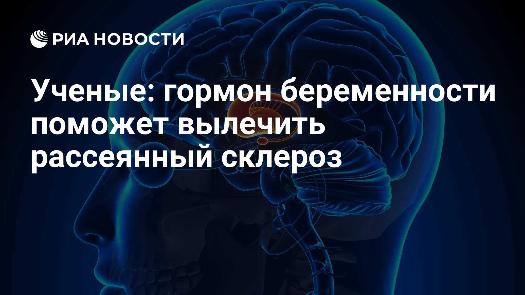 Ученые: гормон беременности поможет вылечить рассеянный склероз - РИА  Новости, 11.12.2017