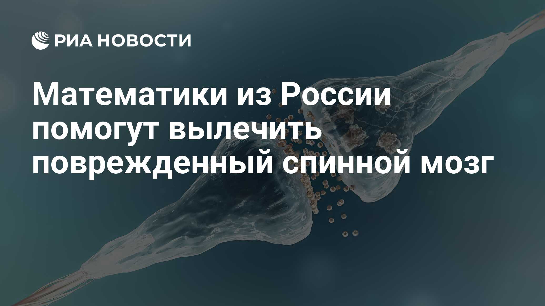 Мозг парализует. Нейропротез. Нейропротезы картинка для презентации. Функции нейропротезов.