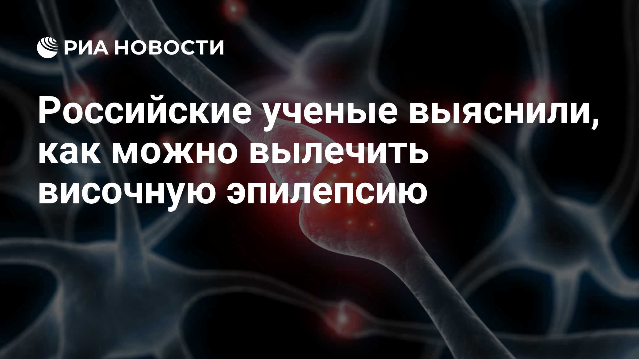 Российские ученые выяснили, как можно вылечить височную эпилепсию - РИА  Новости, 26.12.2017