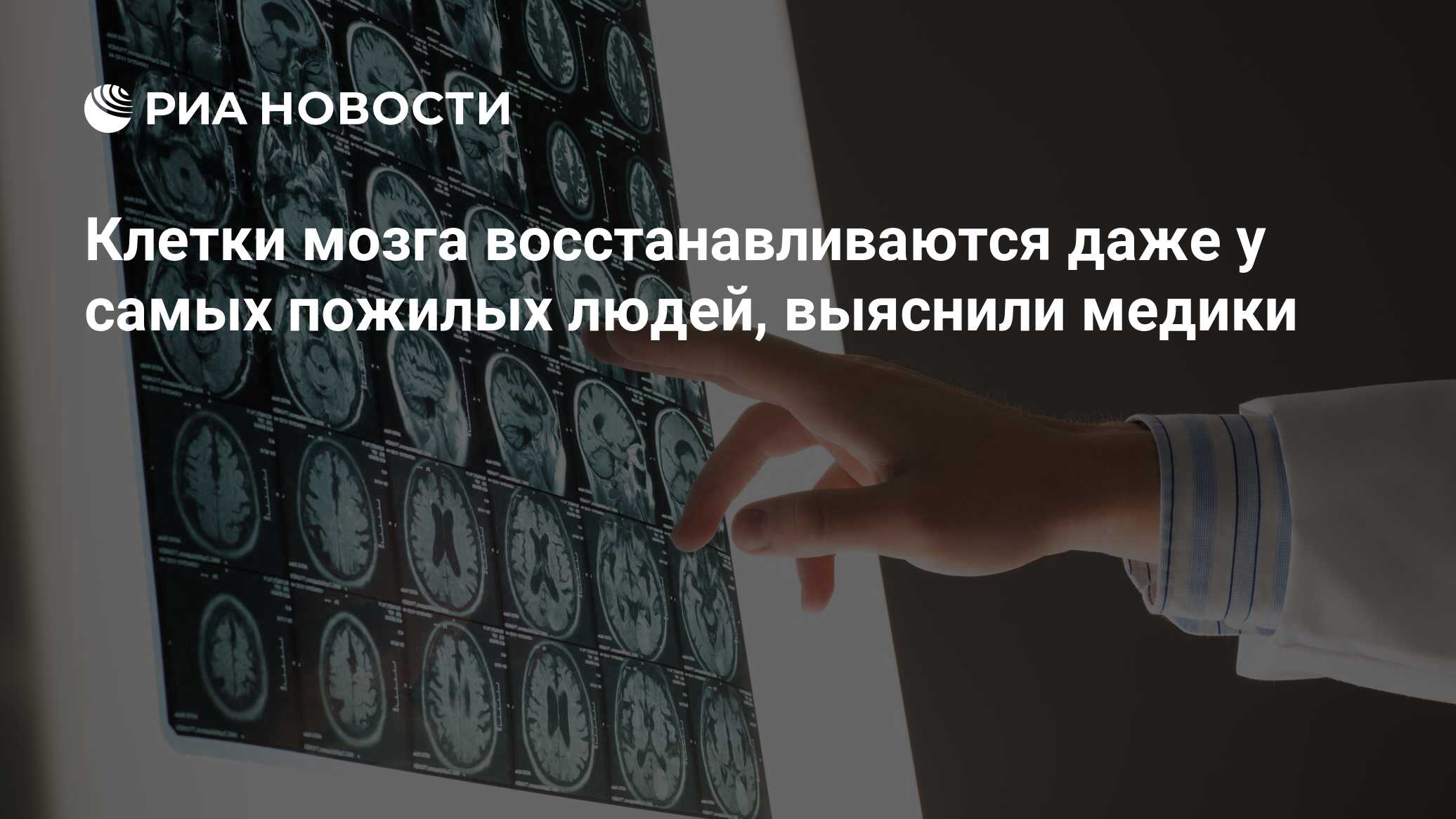 Клетки мозга восстанавливаются даже у самых пожилых людей, выяснили медики  - РИА Новости, 06.04.2018