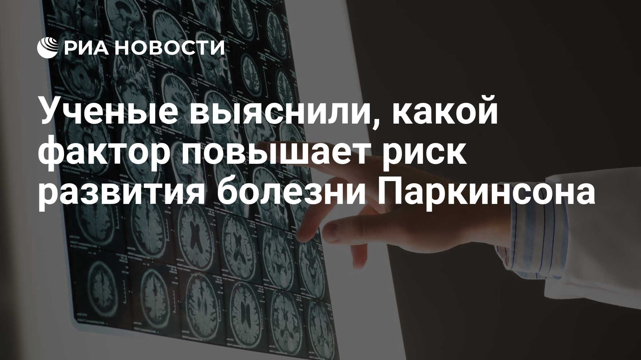 Ученые выяснили, какой фактор повышает риск развития болезни паркинсона
