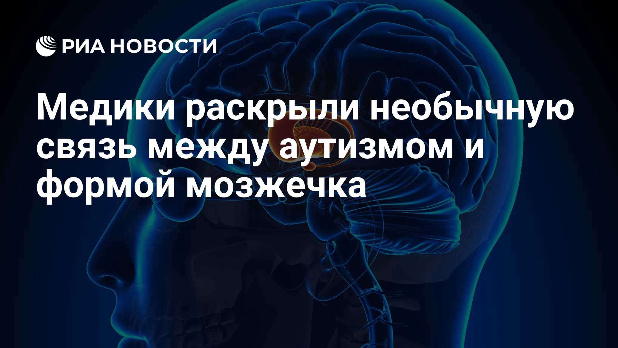 Медики раскрыли необычную связь между аутизмом и формой мозжечка - РИА  Новости, 12.07.2018