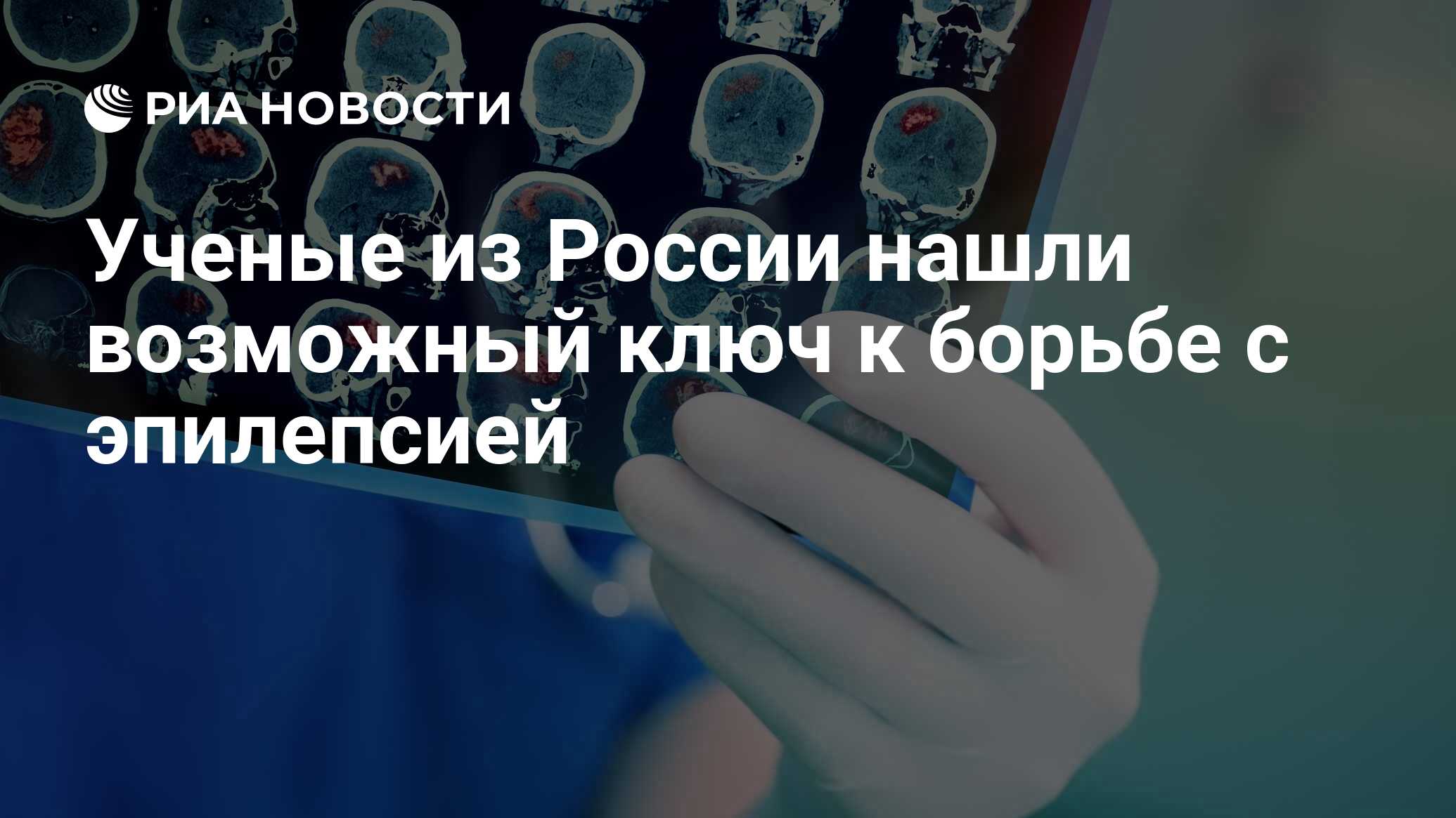 Ученые из России нашли возможный ключ к борьбе с эпилепсией - РИА Новости,  30.07.2018