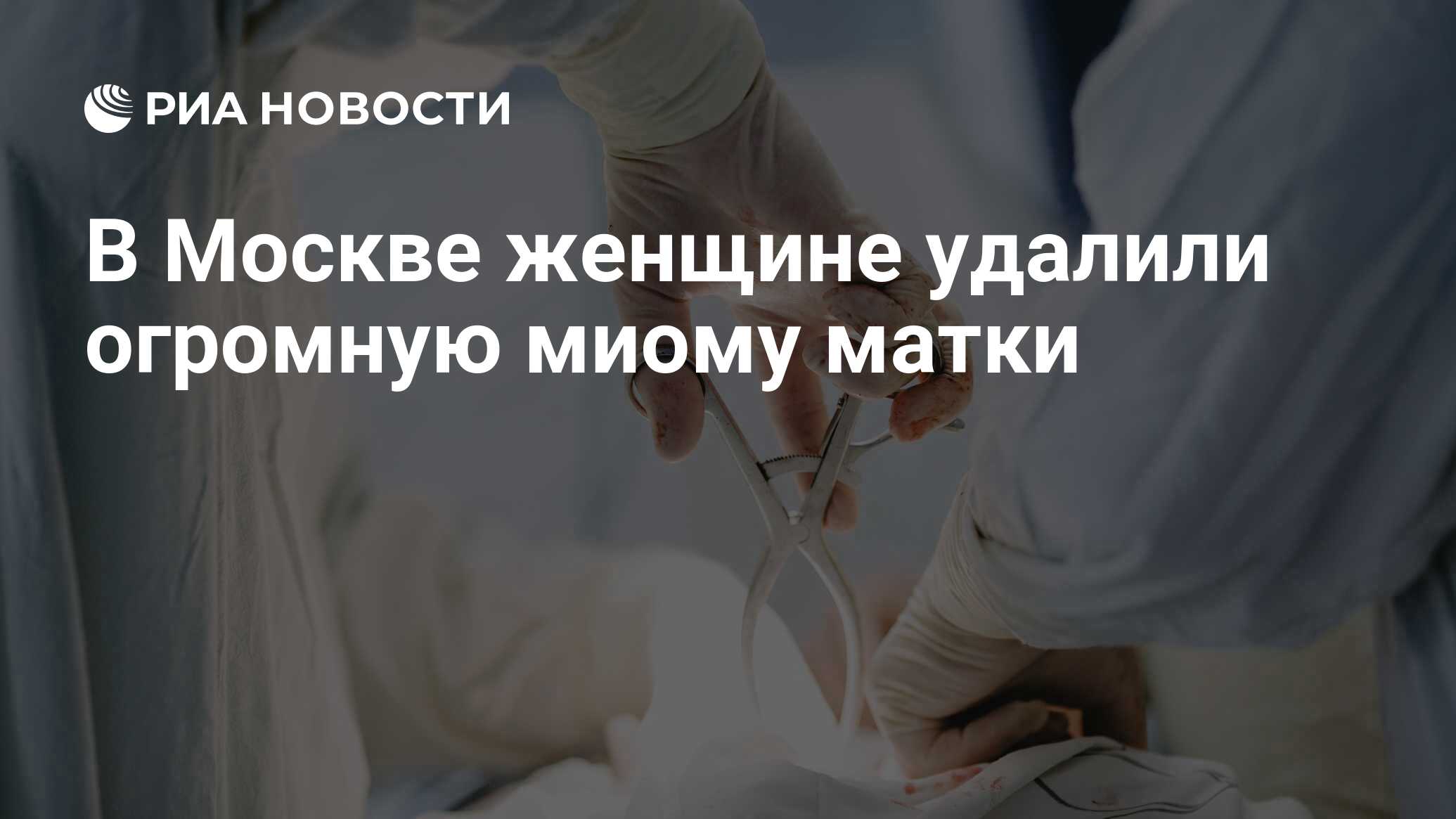 В Москве женщине удалили огромную миому матки - РИА Новости, 03.03.2020