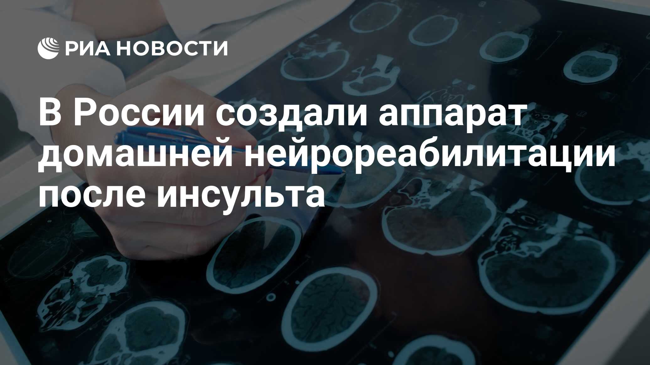 В России создали аппарат домашней нейрореабилитации после инсульта - РИА  Новости, 03.03.2020