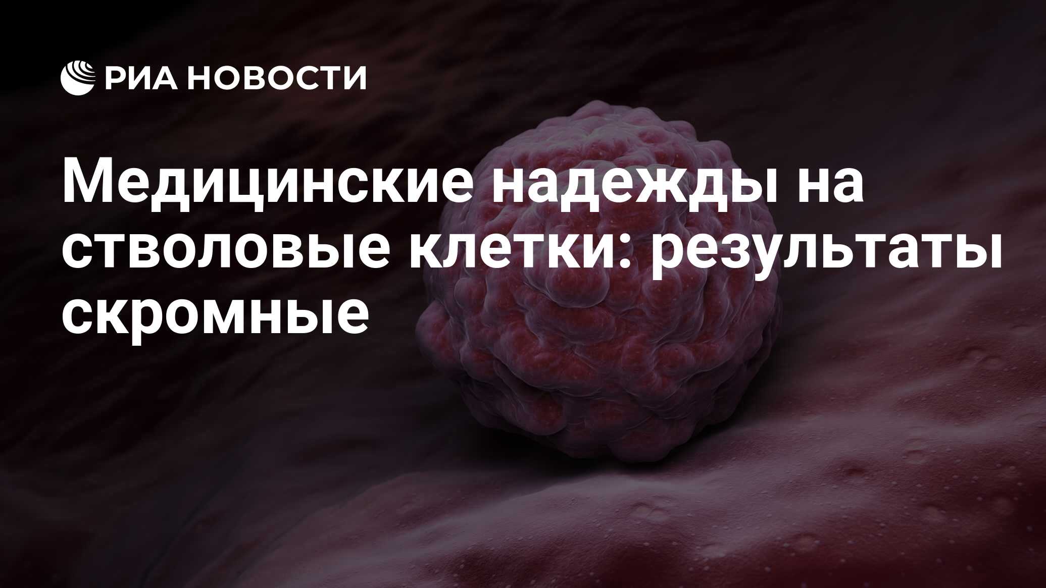 Медицинские надежды на стволовые клетки: результаты скромные - РИА Новости,  09.03.2019