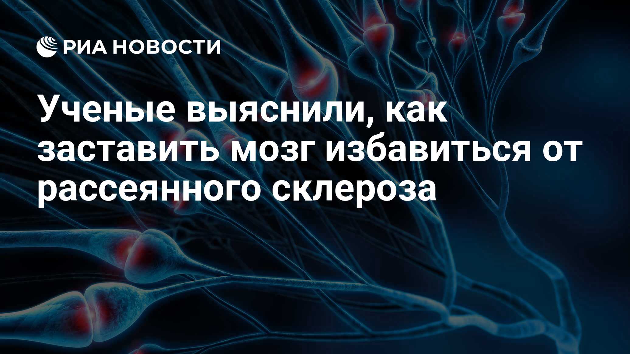 Ученые выяснили, как заставить мозг избавиться от рассеянного склероза -  РИА Новости, 05.07.2019