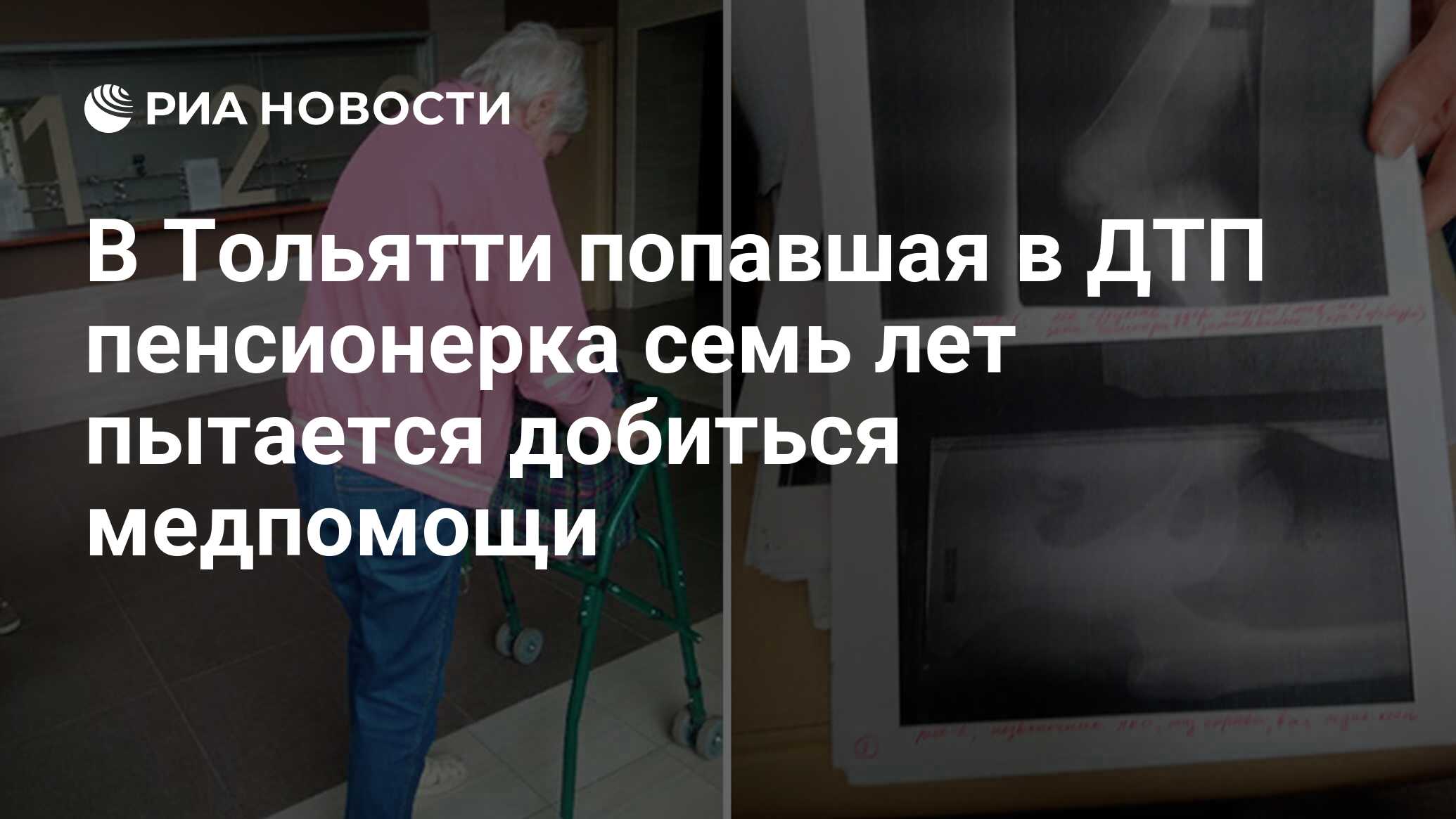 В Тольятти попавшая в ДТП пенсионерка семь лет пытается добиться медпомощи  - РИА Новости, 13.07.2019