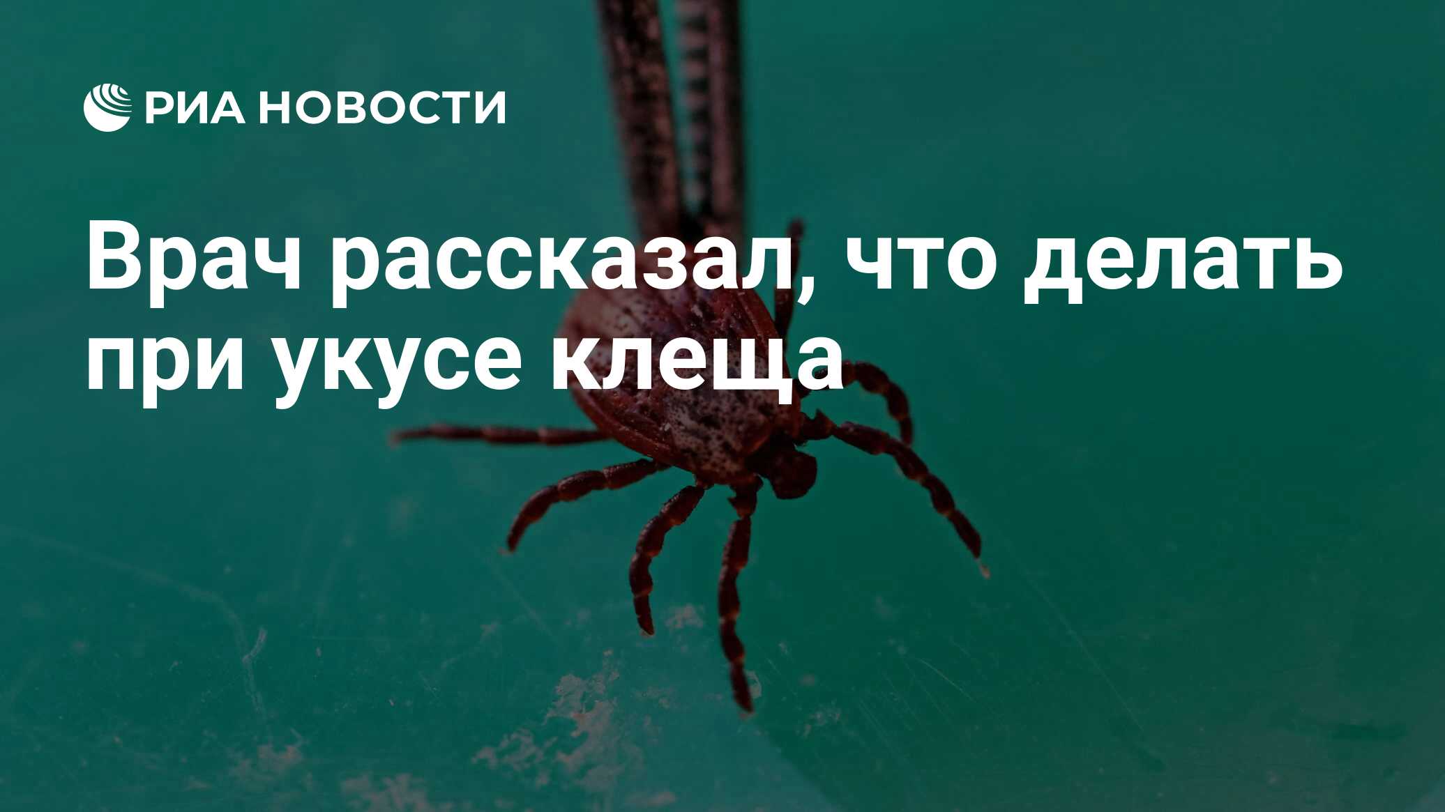 Врач рассказал, что делать при укусе клеща - РИА Новости, 12.03.2020